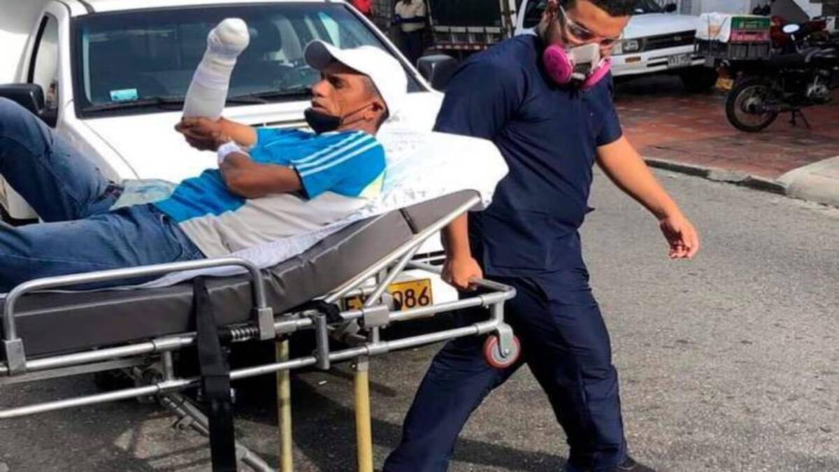 En cirugía de 14 horas le salvan la mano a un venezolano en Bucaramanga